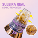 Removedor de Cravos Skin Essence Pro