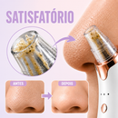 Removedor de Cravos Skin Essence Pro